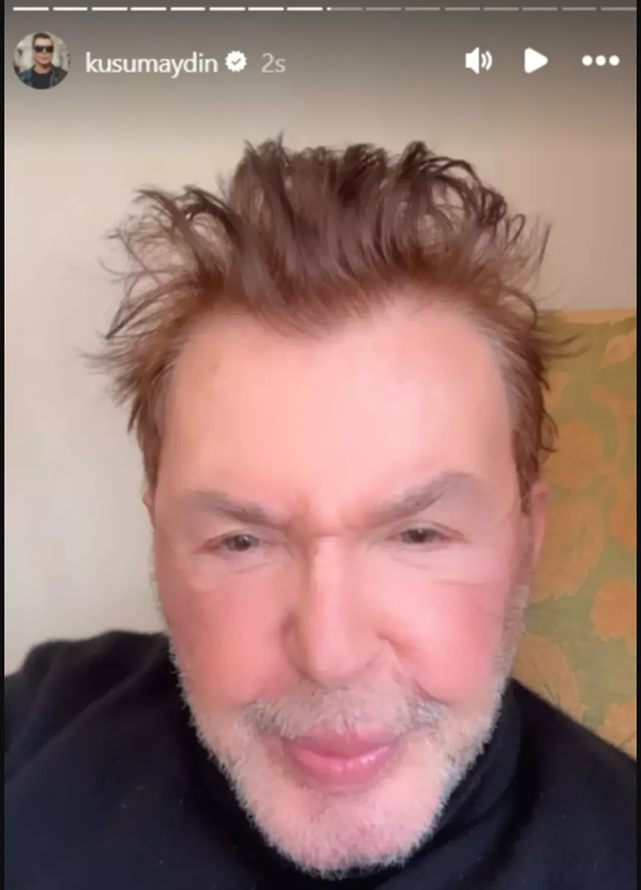 Kuşum Aydın'ı görenler gözlerine inanamadı! Son haline yorum yağdı 