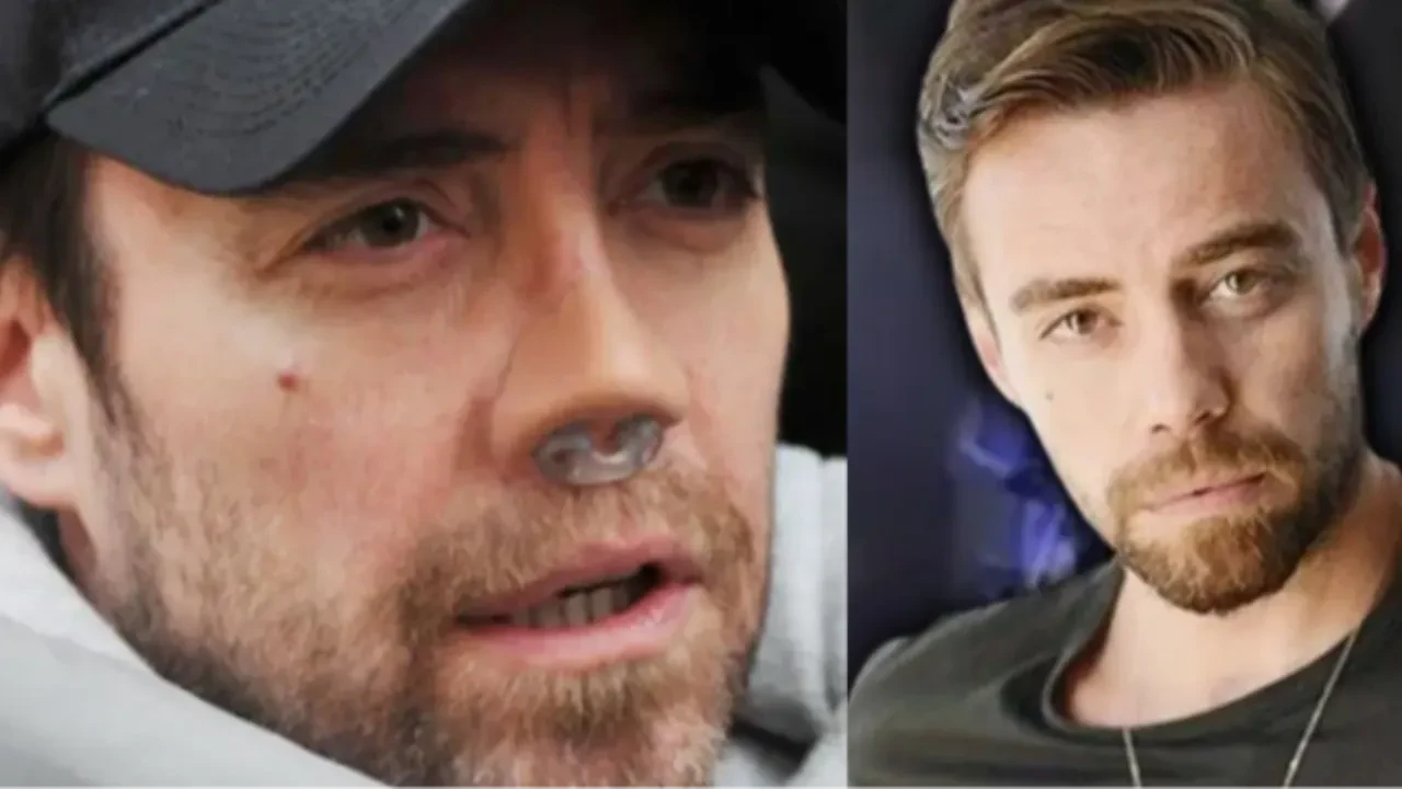 Murat Dalkılıç, burun ameliyatı sonrası bandajsız halini ilk kez paylaştı! Yeni burnuna kavuşan Dalkılıç'ın son görüntüsü şaşırttı!