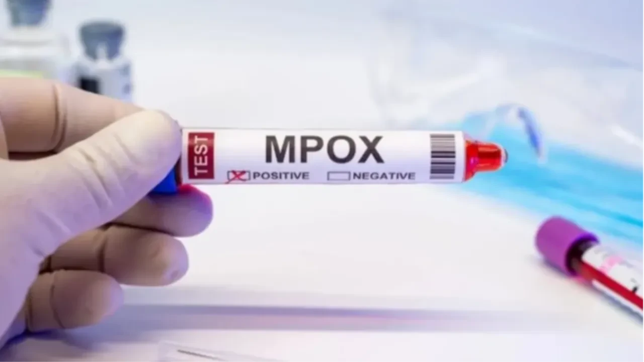 Gana'da M Çiçeği bilançosu açıklandı: 1000'den fazla vaka doğrulandı aşılama seferberliği başlattı!