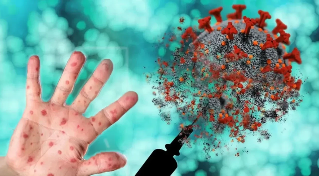 Gana'da M Çiçeği bilançosu açıklandı: 1000'den fazla vaka doğrulandı aşılama seferberliği başlattı!