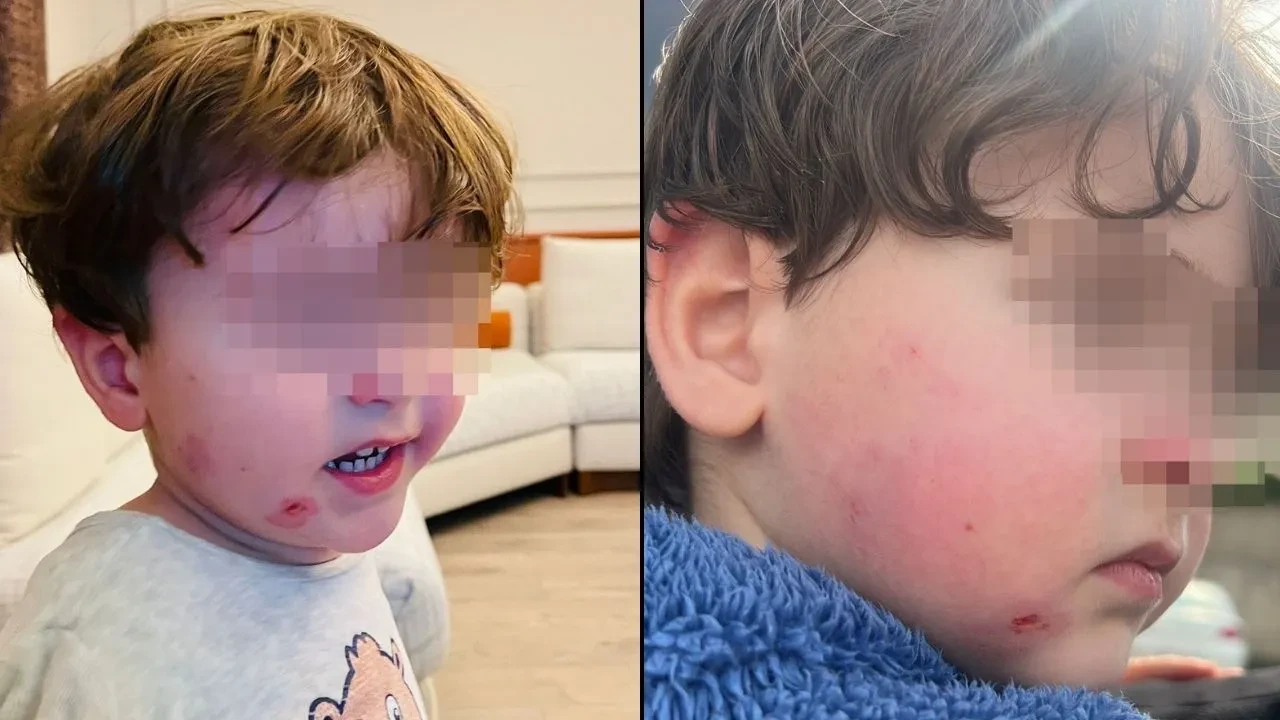 Kreşte 2,5 yaşındaki çocuğa darp! Çocuğunu o halde gören anne şok yaşadı