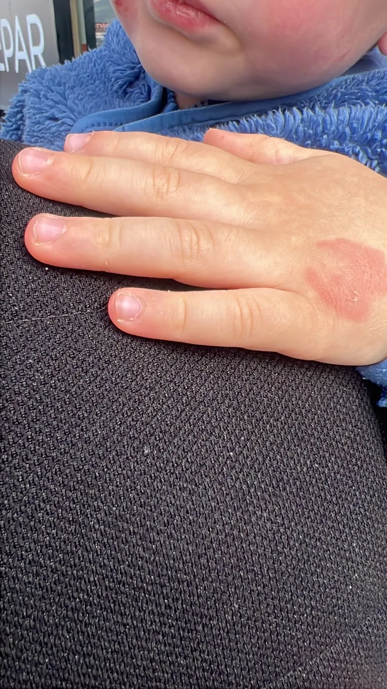 Kreşte 2,5 yaşındaki çocuğa darp! Çocuğunu o halde gören anne şok yaşadı