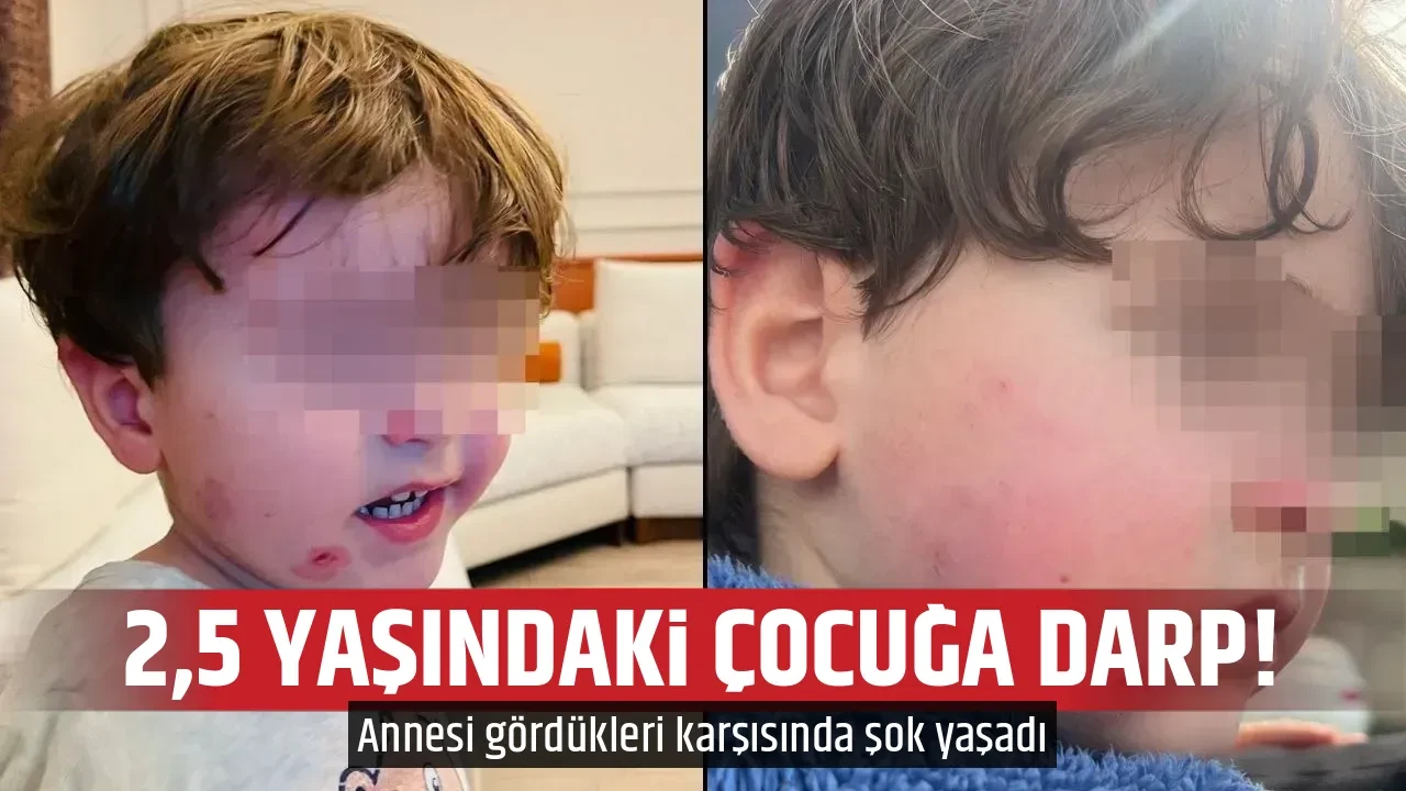 2,5 YAŞINDAKİ ÇOCUĞA DARP!