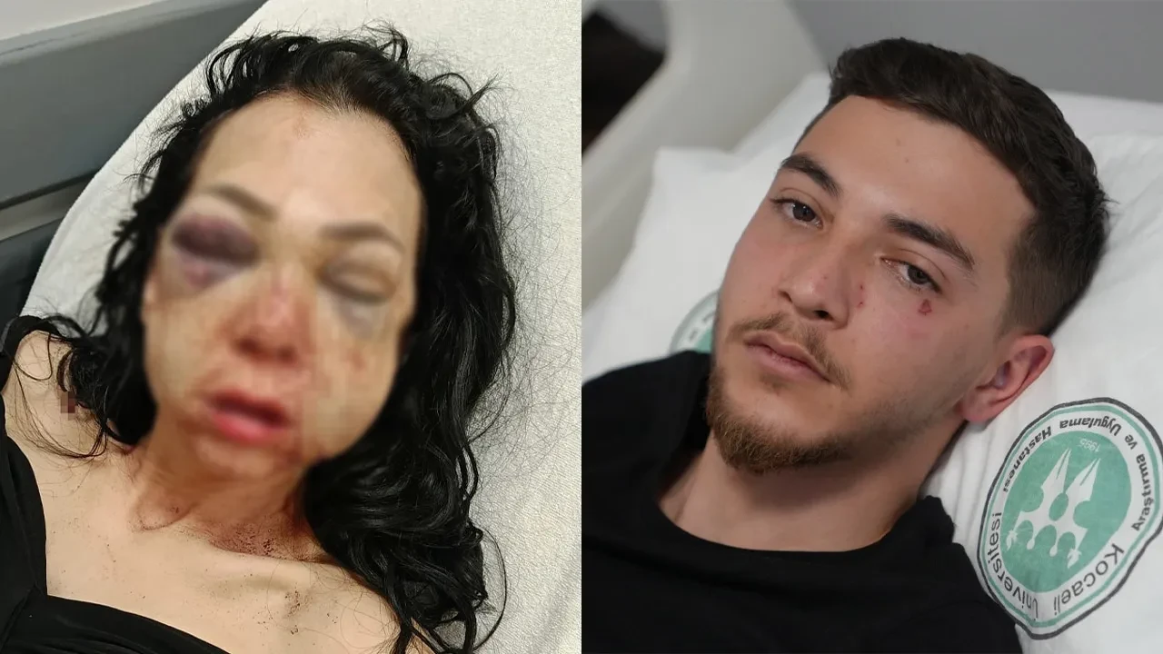 Bayram günü anne ve oğlunu darbetmişlerdi! Kan donduran ifadeleri ortaya çıktı: 