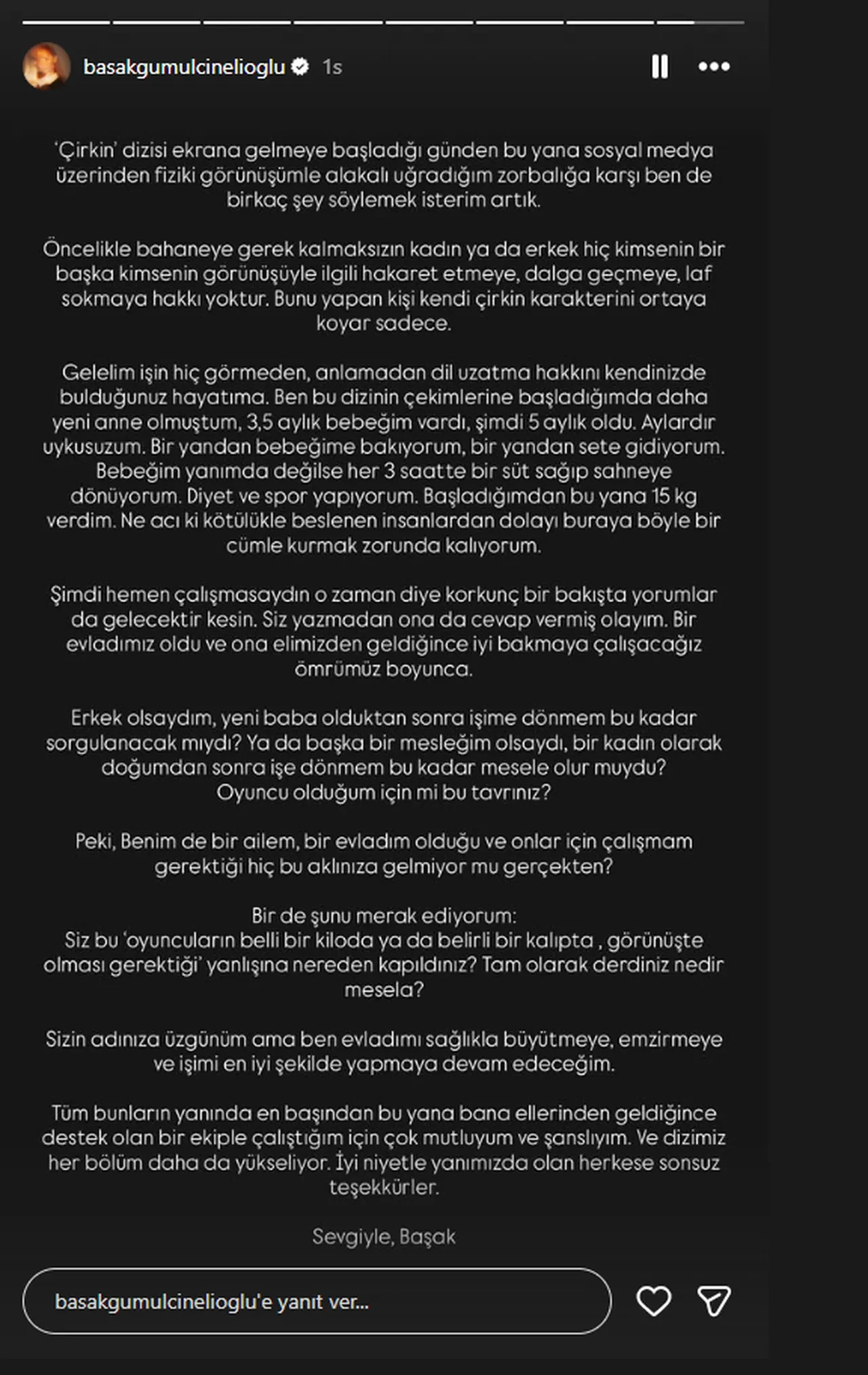 Çirkin dizisinin Lale'si Başak Gümülcinelioğlu fiziksel görünüşüyle ilgili uğradığı zorbalıkları anlattı 