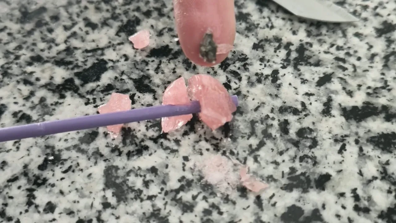 Küçük kızın yediği şekerden taş çıktı