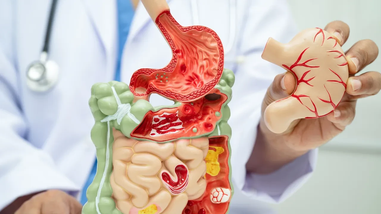 Akasya zamkı bağırsak içini yumuşatıyor! Jel kıvamıyla İyi bakterilere yardım ediyor