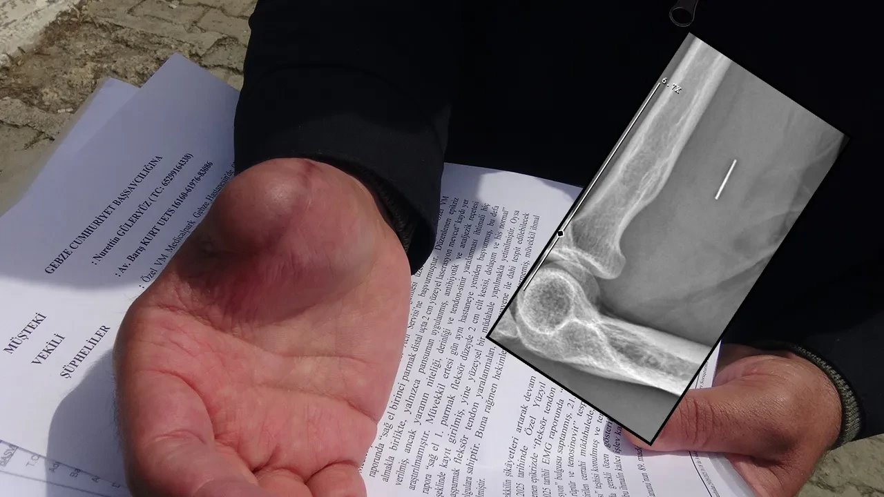 Kurban Bayramı’nda parmağını kesti, tıbbi ihmalin kurbanı oldu! Hem parmağını hem işini kaybetti