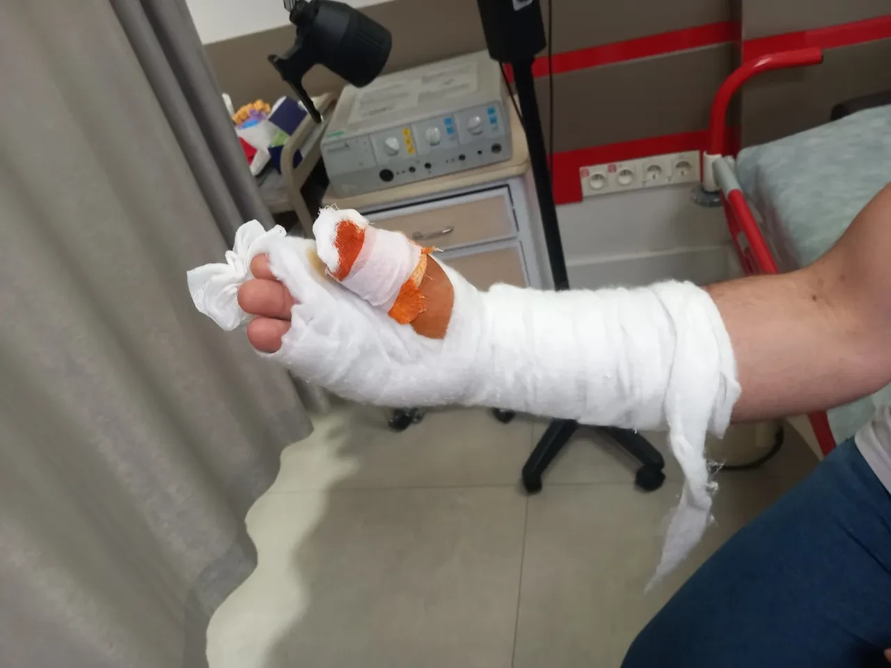 Kurban Bayramı’nda parmağını kesti, tıbbi ihmalin kurbanı oldu! Hem parmağını hem işini kaybetti