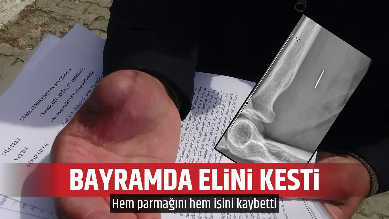 BAYRAMDA ELİNİ KESTİ