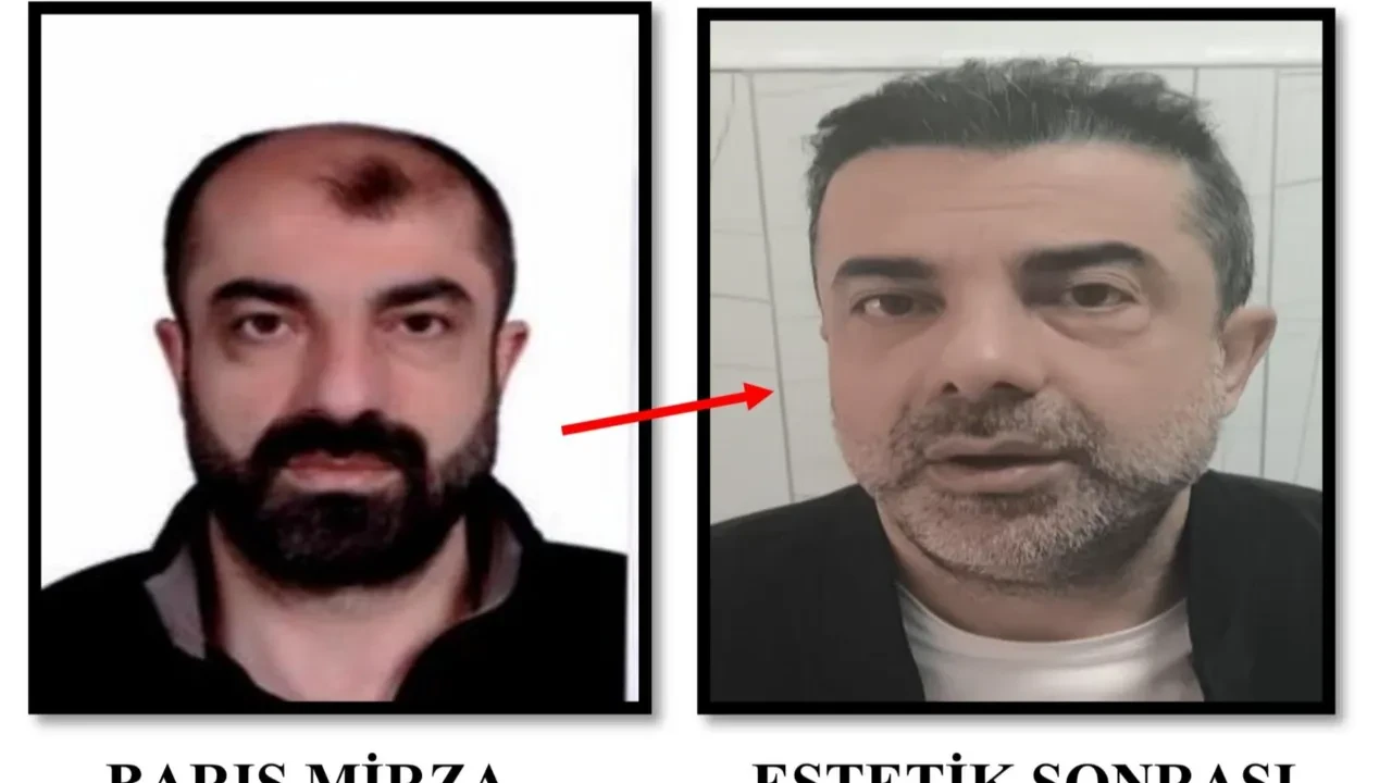 Cinayet işledi, yakalanmamak için ameliyat ile yüzünü değiştirdi! Firari zanlı, 7 yıl sonra yakayı ele verdi