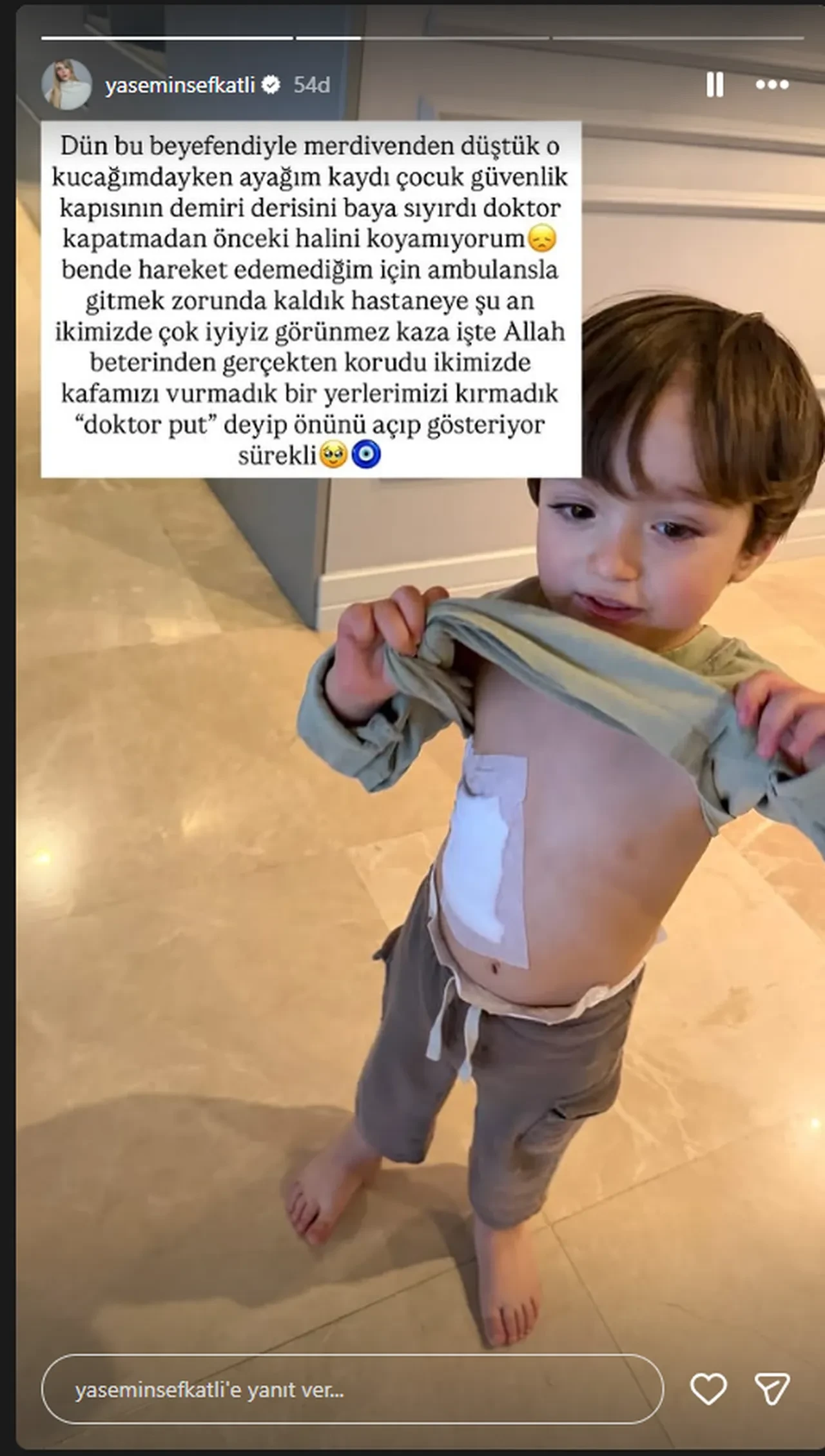 İbrahim Tatlıses'in torunu merdivenden düştü! Ambulansla hastaneye kaldırıldı 