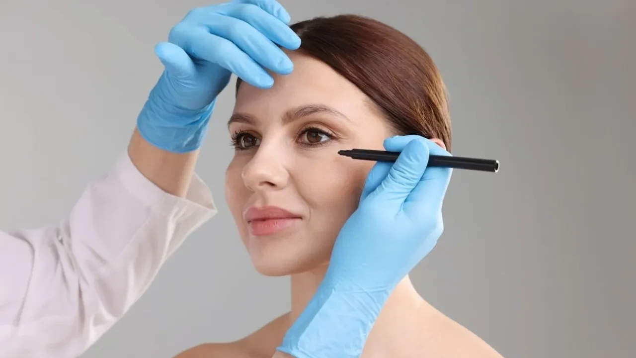 Ebru Gündeş'i 10 yaş gençleştiren Yüz gerdirme işlemi: Mini facelift! Daha genç görünmek isteyenlerin yeni adresi, peki kimler yüz gerdirme yaptırmalı? 