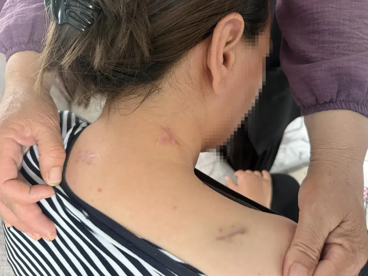 Koca dehşetinden ölü numarasıyla kurtuldu! 17 yerinden bıçaklanmıştı: Kızımın çığlıkları hala kulağımda