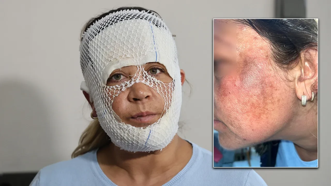 'Prenses cilt bakımı' hüsranla bitti: Yüzü yandı, güzellik merkezinden dalga geçer gibi cevap aldı