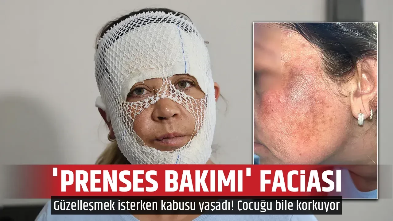'PRENSES BAKIMI' FACİASI