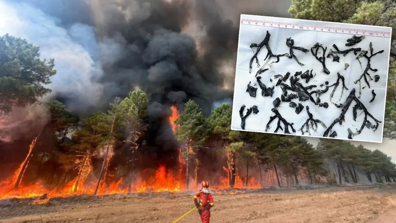 Nefes darlığı şikayetiyle hastaneye gitti, vücudundan çıkanlar şaşkına çevirdi