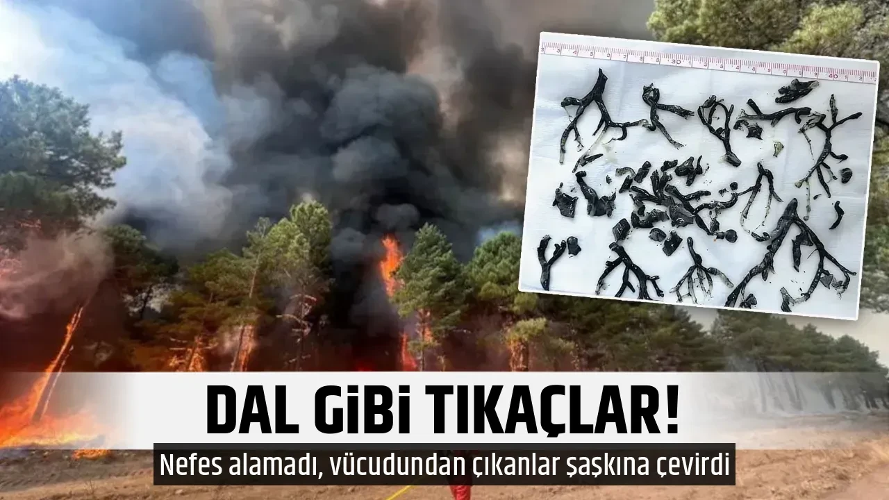 DAL GİBİ TIKAÇLAR!