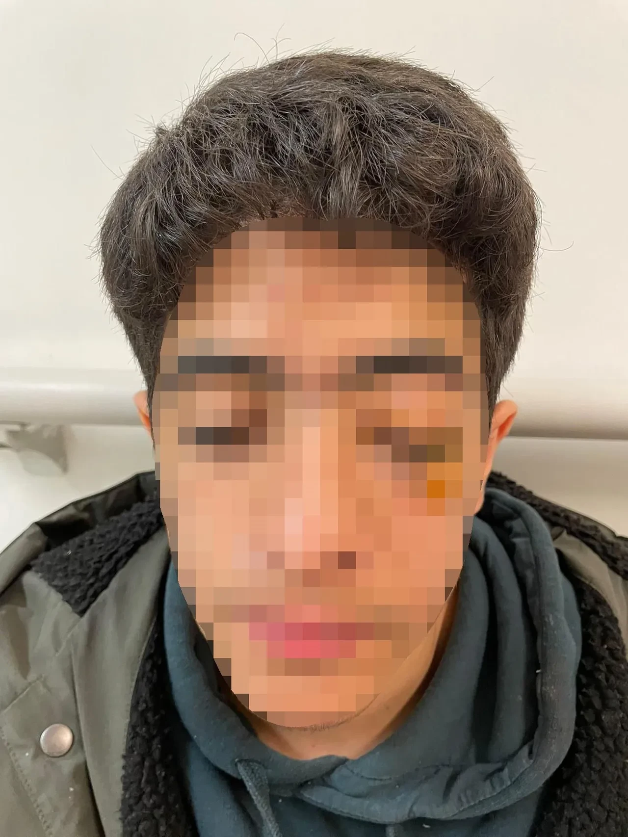 "Bana şaka yapma" dedi, muşta ile darbedildi: 15 yaşındaki çocuk akran zorbalığının kurbanı oldu