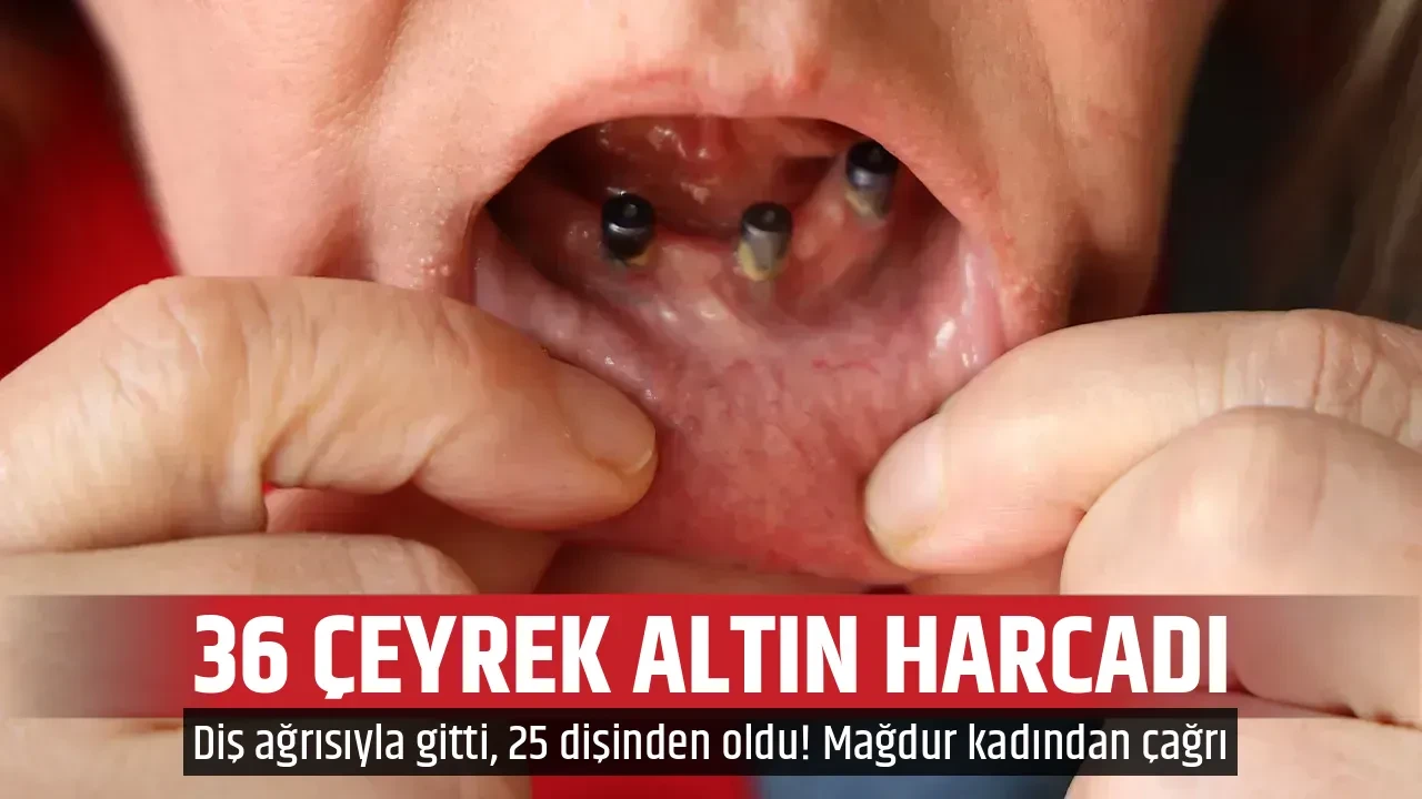 36 ÇEYREK ALTIN HARCADI