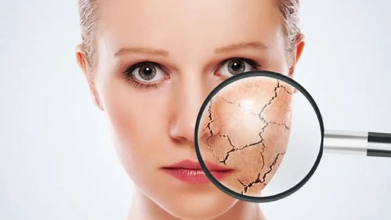 Gençleşmek isterken cildinizden olmayın! Uzmanlar uyardı, bu ürünlerden kesinlikleuzak durun