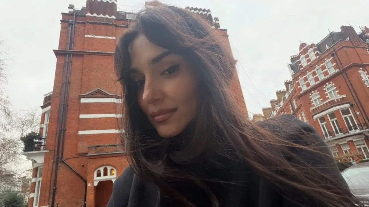 Hande Erçel'in yüzüne ne oldu? Hande Erçel estetik mi yaptırdı?