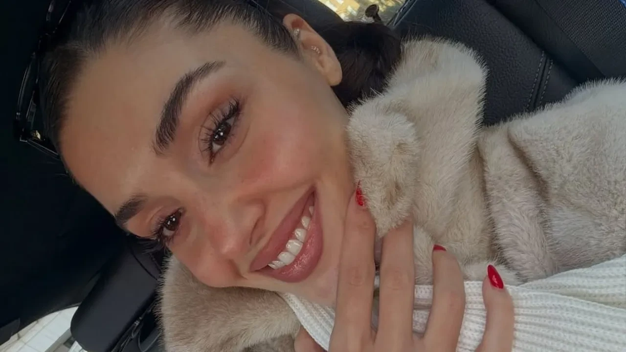 Hande Erçel'in yüzüne ne oldu? Hande Erçel estetik mi yaptırdı?