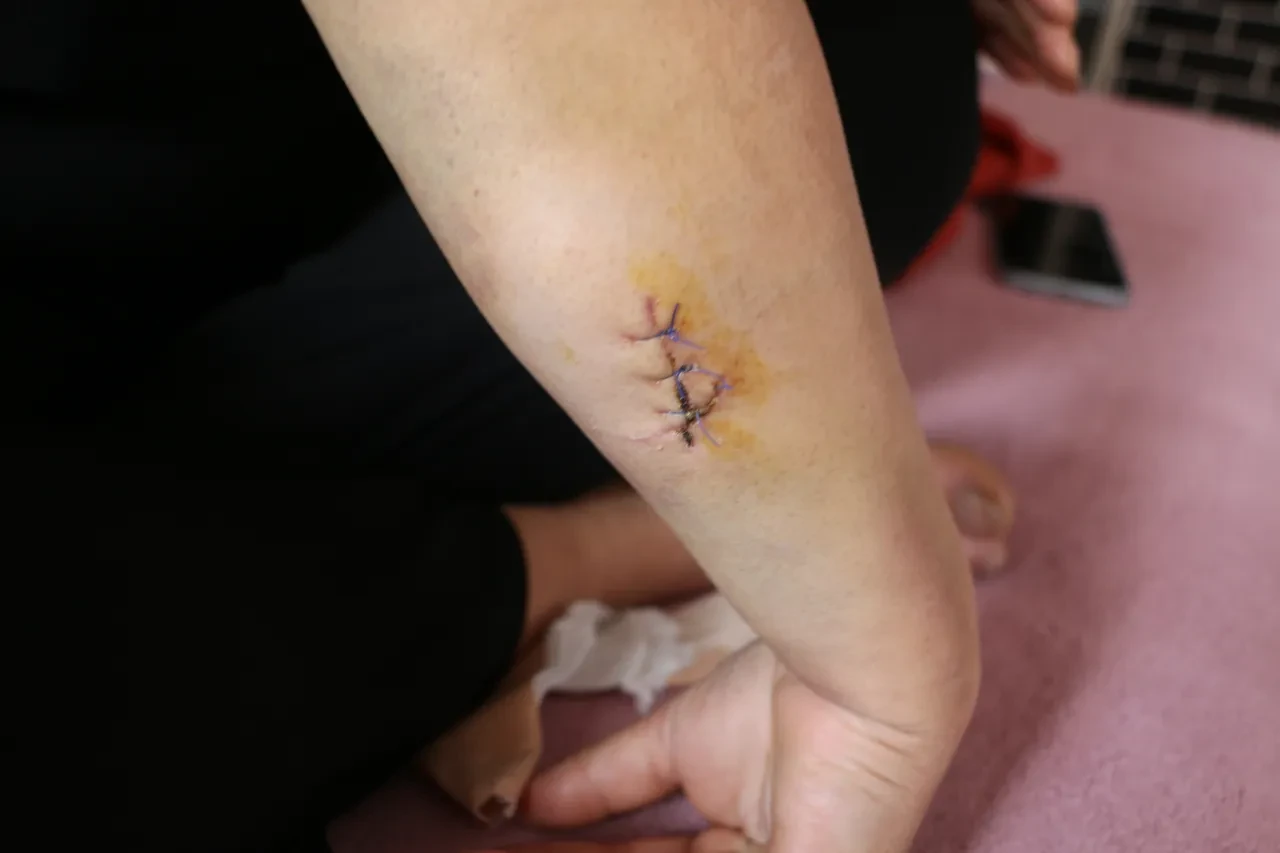 Diyarbakır'da vahşet! 30 yerinden bıçaklanan kadın feryat etti: Çıkıp beni öldürecek