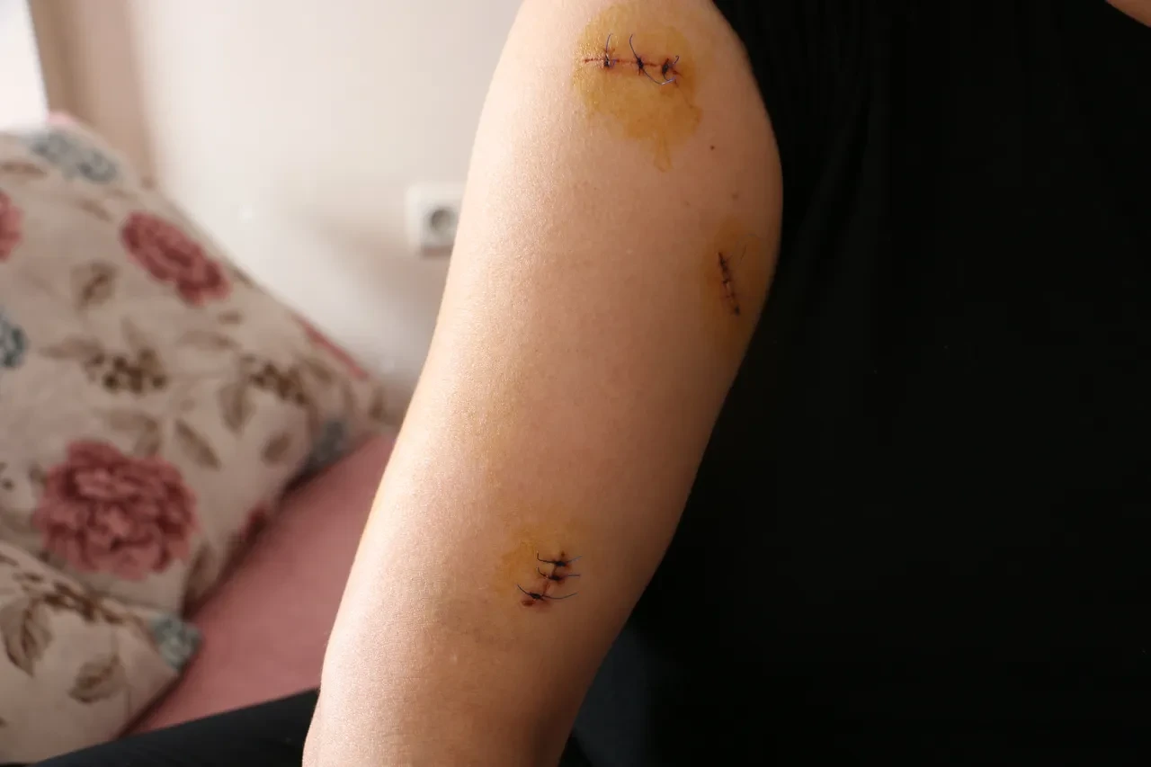 Diyarbakır'da vahşet! 30 yerinden bıçaklanan kadın feryat etti: Çıkıp beni öldürecek