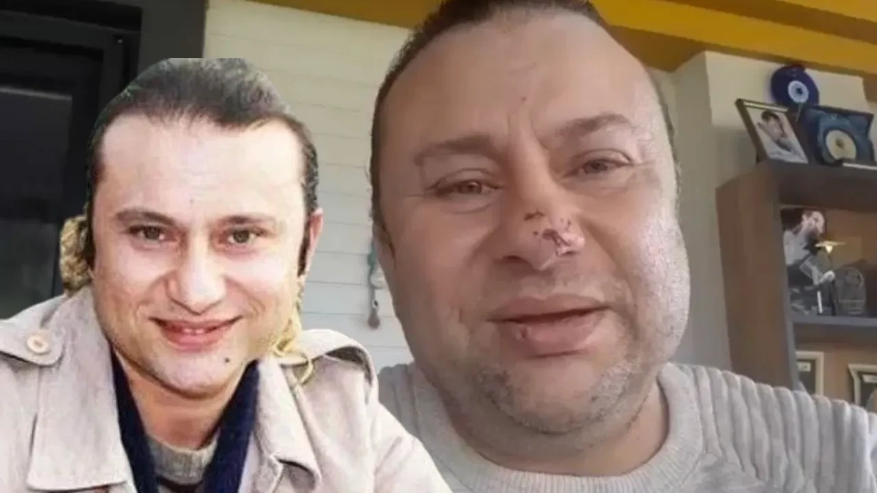 Onur Akay et yiyen bakteri ile savaşıyor! Pitbull saldırısıyla başına gelenleri anlattı: İlk işaretine dikkat!