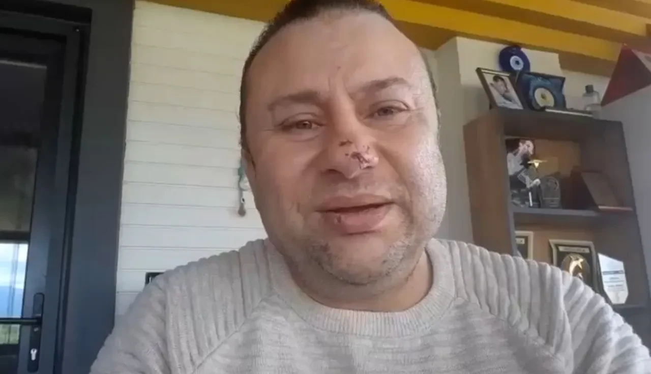 Onur Akay et yiyen bakteri ile savaşıyor! Pitbull saldırısıyla başına gelenleri anlattı: İlk işaretine dikkat!