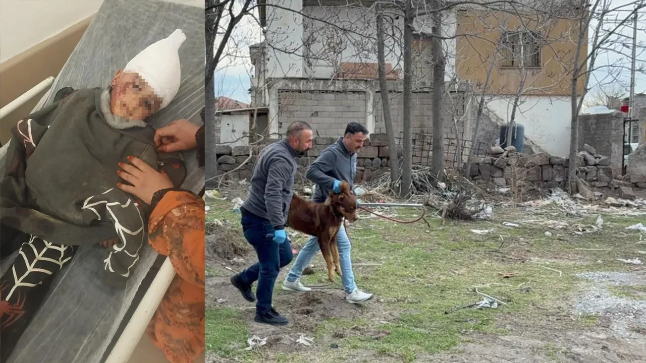 Kayseri’deki köpek saldırısında skandal iddia: 