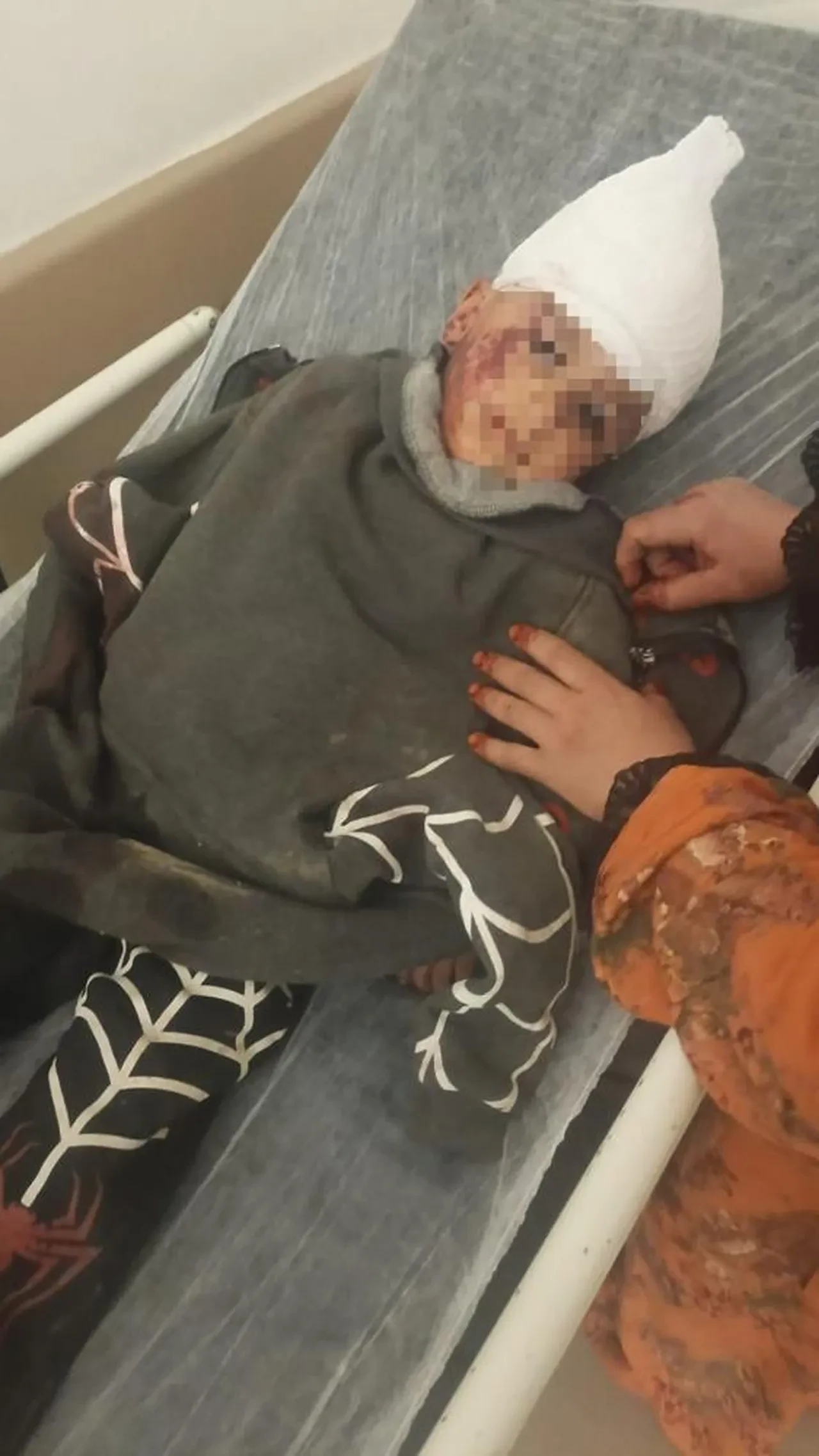 Kayseri’deki köpek saldırısında skandal iddia: "Şikayeti geri çekmemiz için para teklif ettiler!"