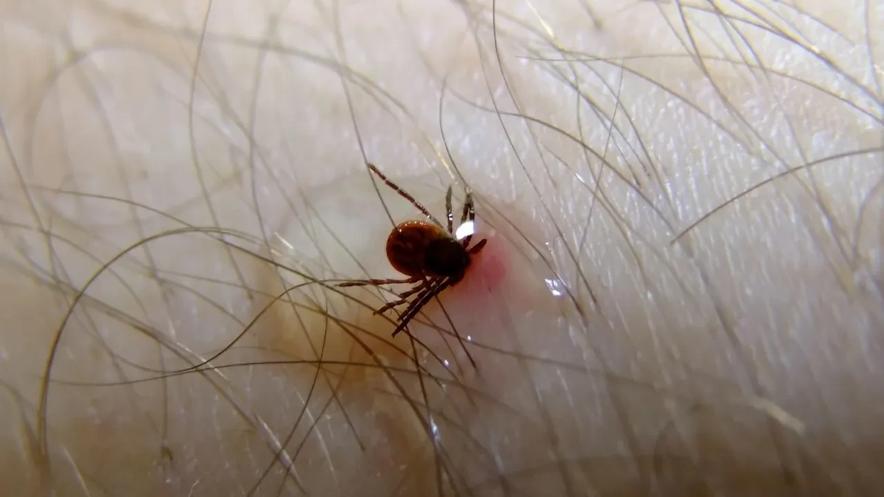 Havaların ısınmasıyla keneler ortaya çıktı! Kene ısırdığında kritik saatler, yapışmış keneye sakın bunu yapmayın