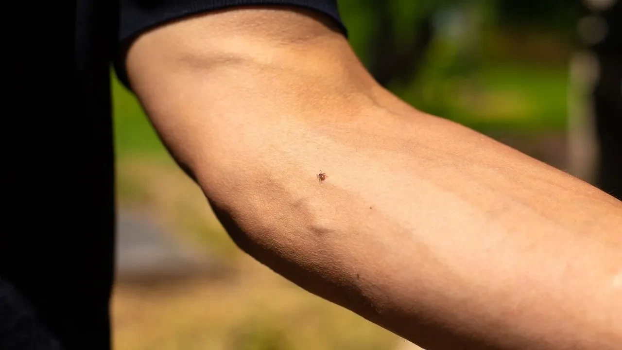 Havaların ısınmasıyla keneler ortaya çıktı! Kene ısırdığında kritik saatler, yapışmış keneye sakın bunu yapmayın