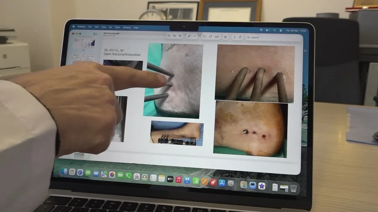 Dünyada benzeri yok, Eskişehir'de üretildi! Enfeksiyonla mücadelede ezber bozan buluş