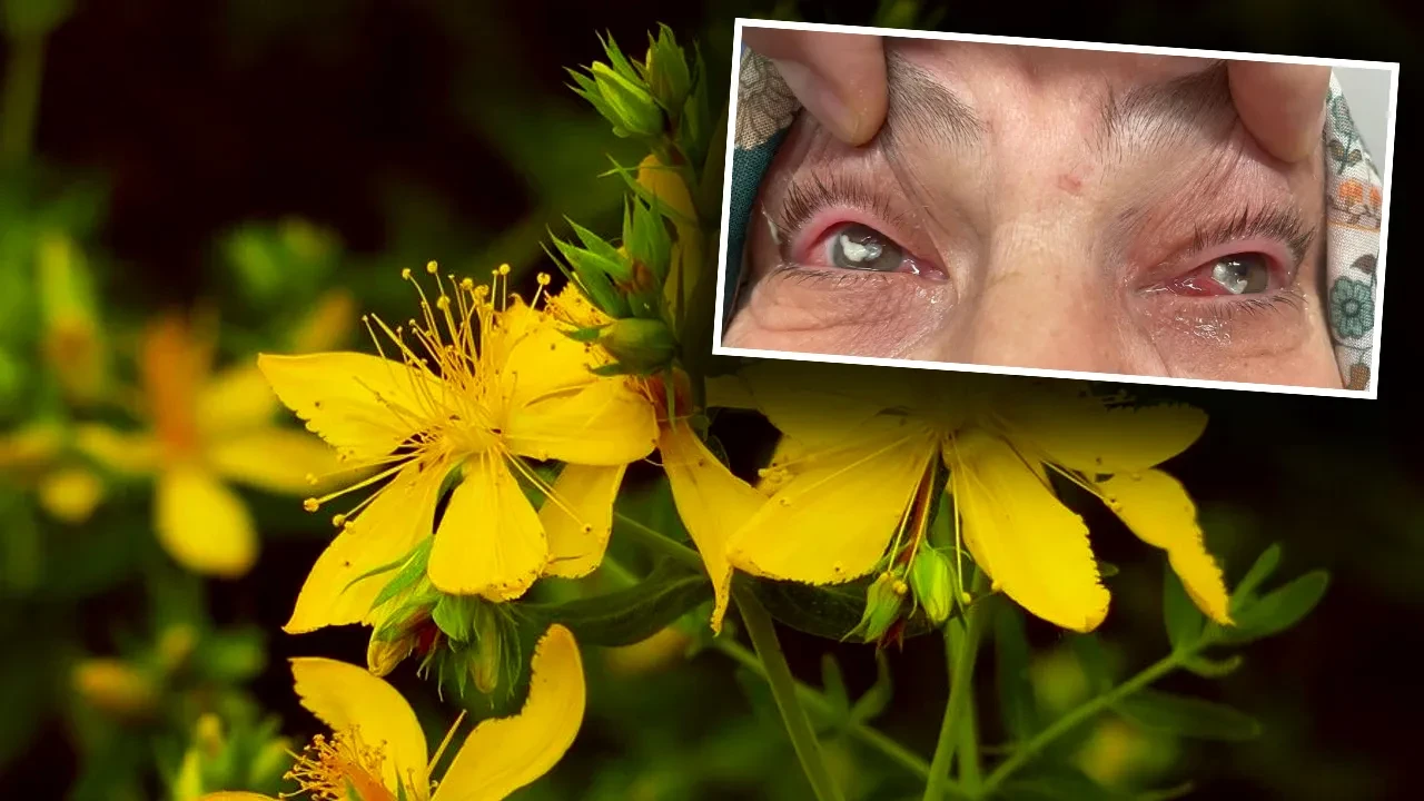 Gözlerine damlattığı Kırlangıç Otu suyu dünyasını kararttı! Gözlükten kurtulmak istedi, önünü göremez oldu