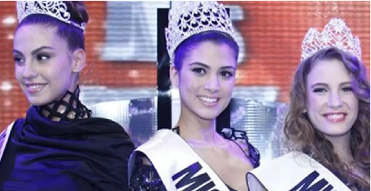 Survivor'da sakatlanan Gizem Memiç'ten sağlık itirafı: 2 yıldır dizim normale dönmedi