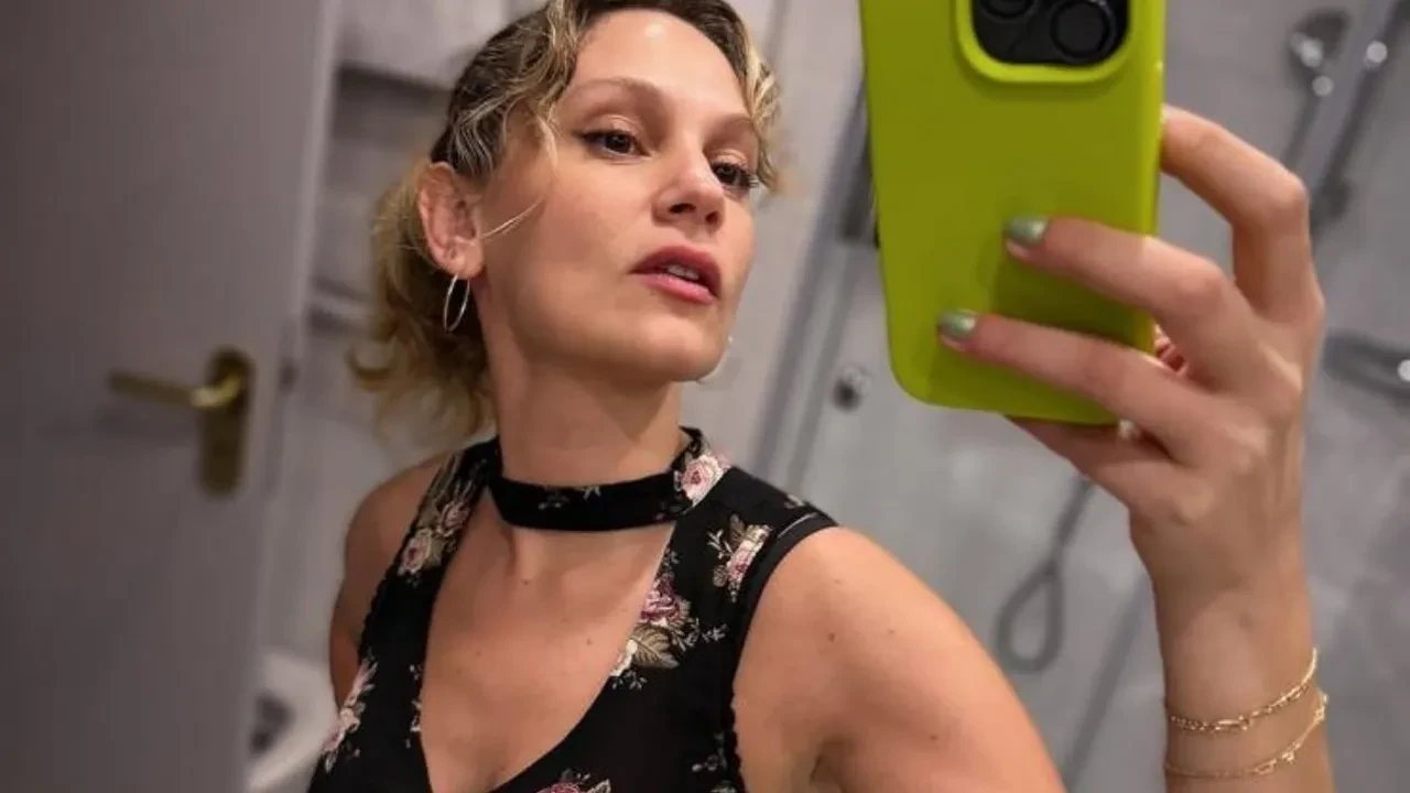 Farah Zeynep Abdullah’tan sevenlerini endişelendiren paylaşım! Vücudundaki morluklar korkuttu 