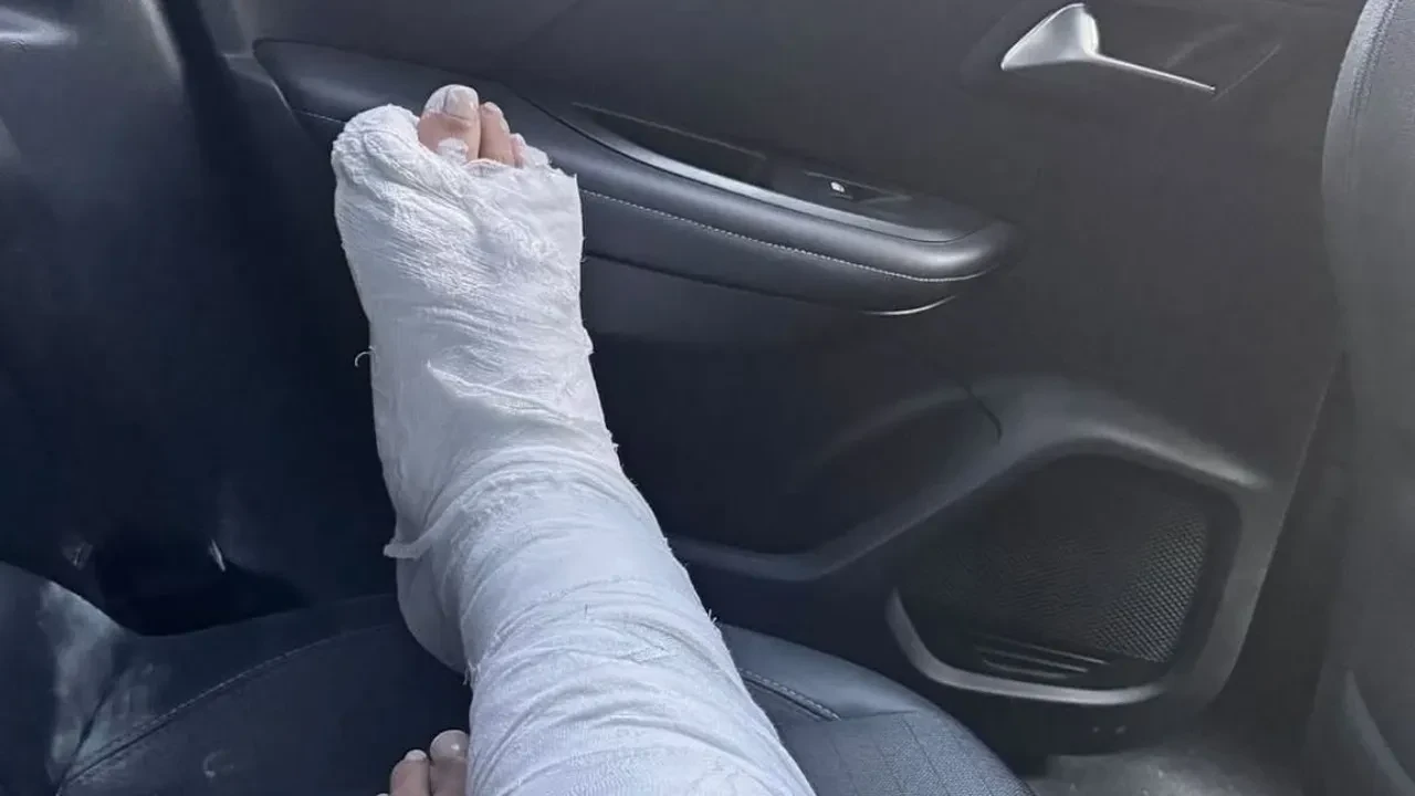 Sevda Demirel vlog çekerken ayağını kırdı! O anlar sosyal medyada viral oldu 