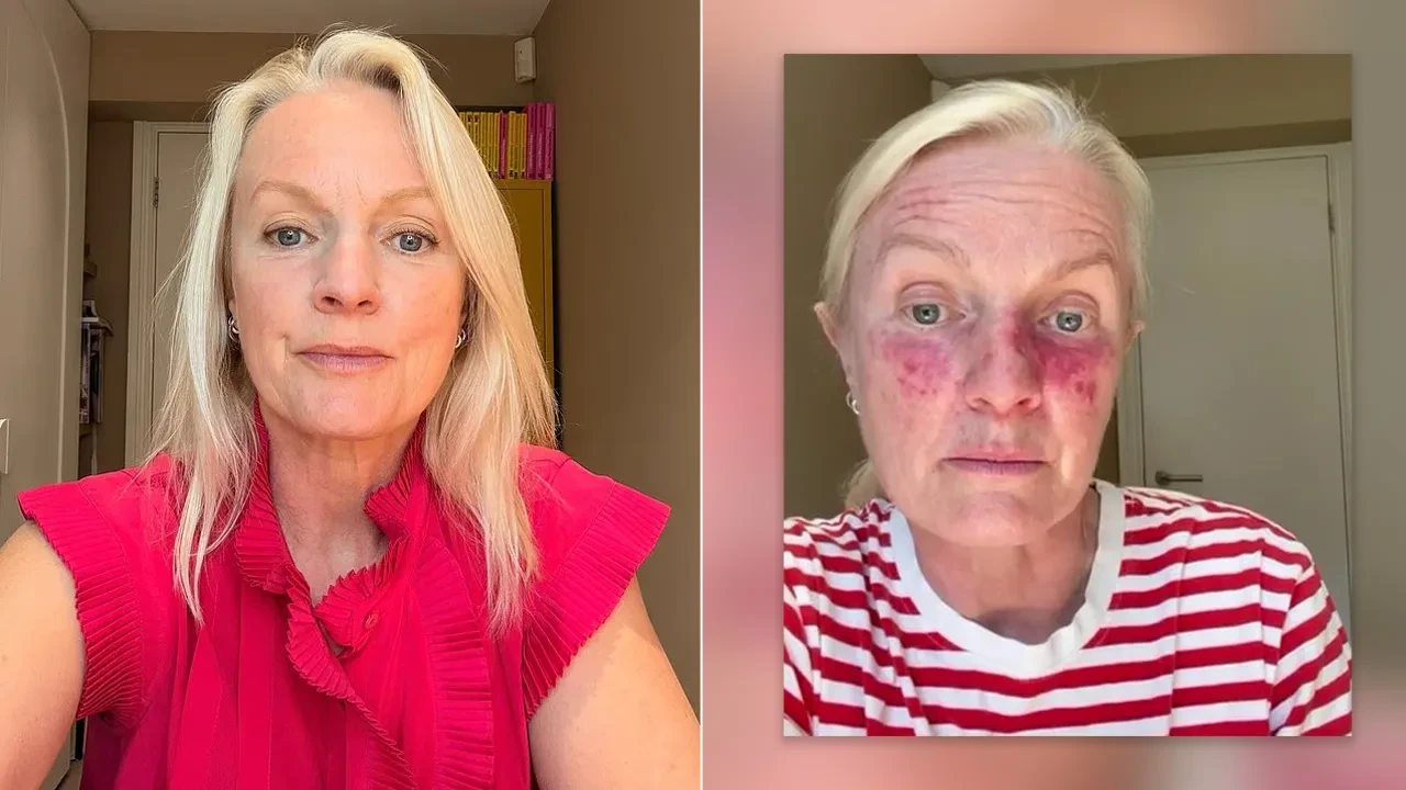 Yıllarca 'yaşlılık lekesi' sandı, gerçek bambaşka çıktı: "Aklımdan bile geçmezdi!"