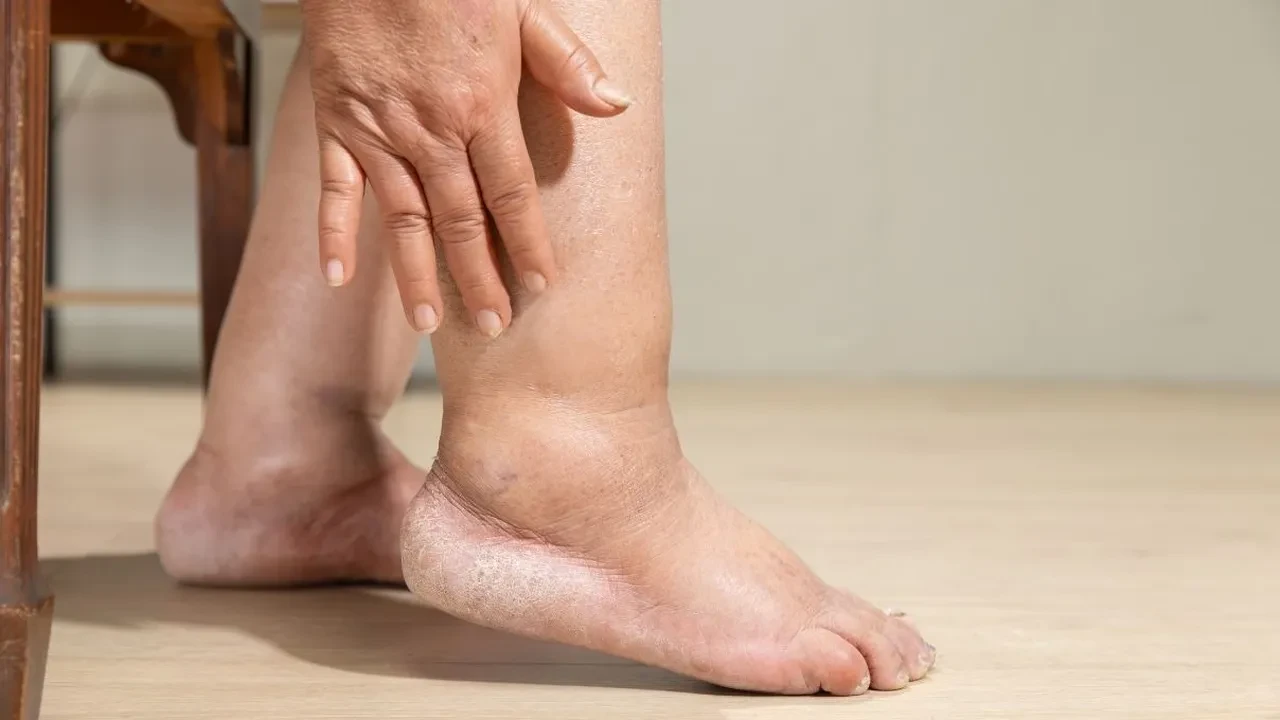 Yazın favori içeceği belli oldu! Hem ferahlatıyor hem ödem atıyor
