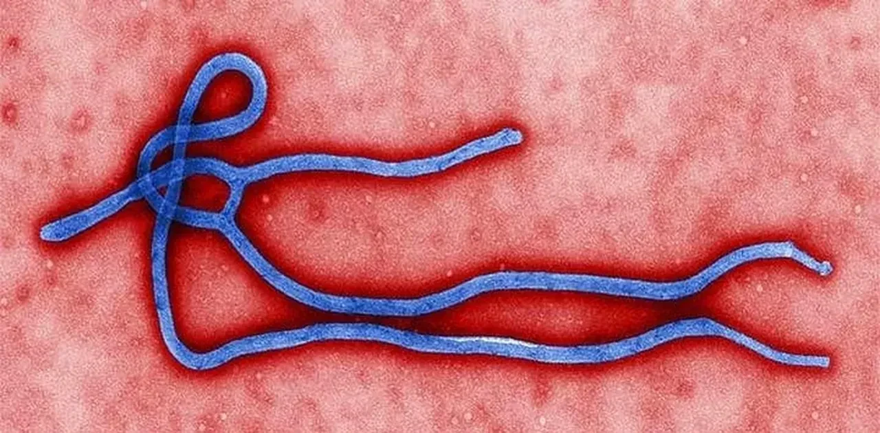 Ebola salgını kontrolden çıktı! İnsanları sadece virüs öldürmüyor, yayılan bilgiler de bir parçası