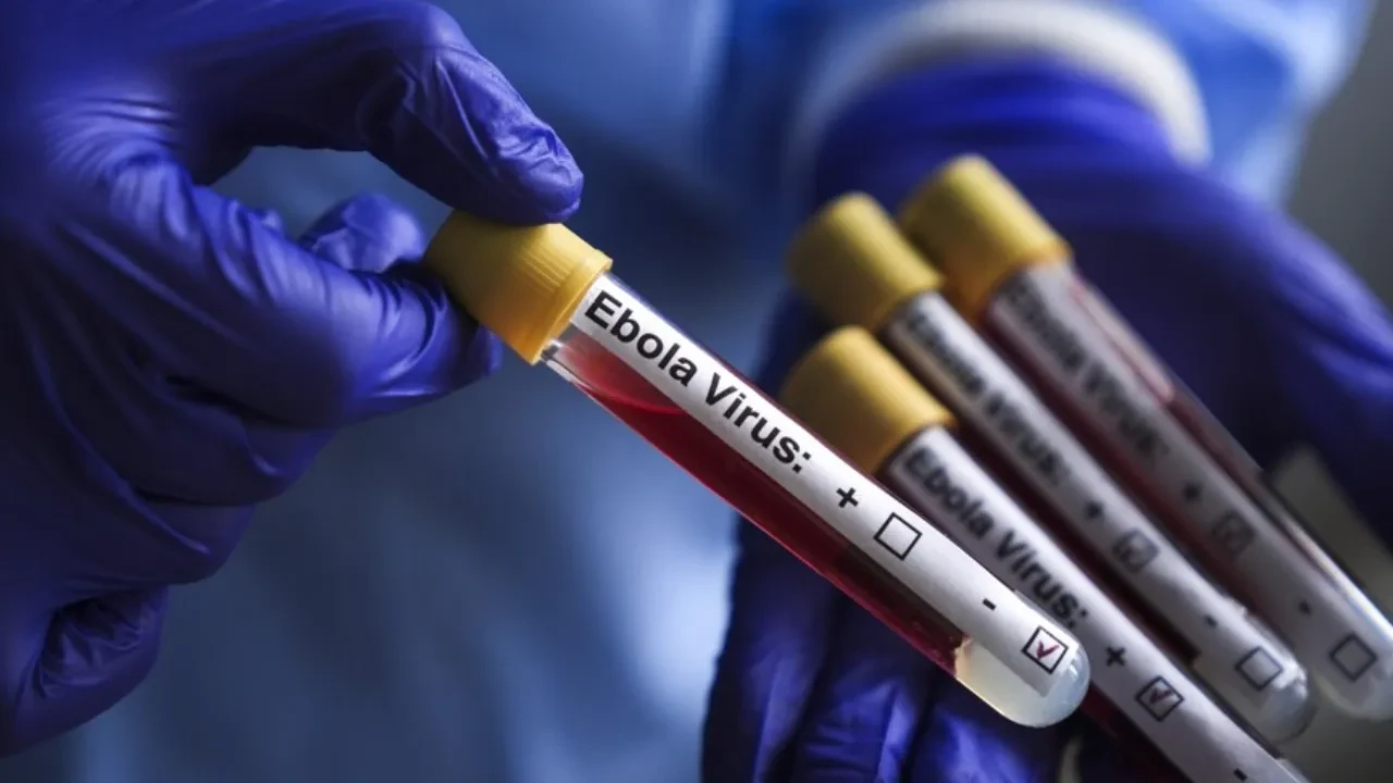 Ebola virüsü Avrupa'ya sıçradı: Ülkede 2 vaka var