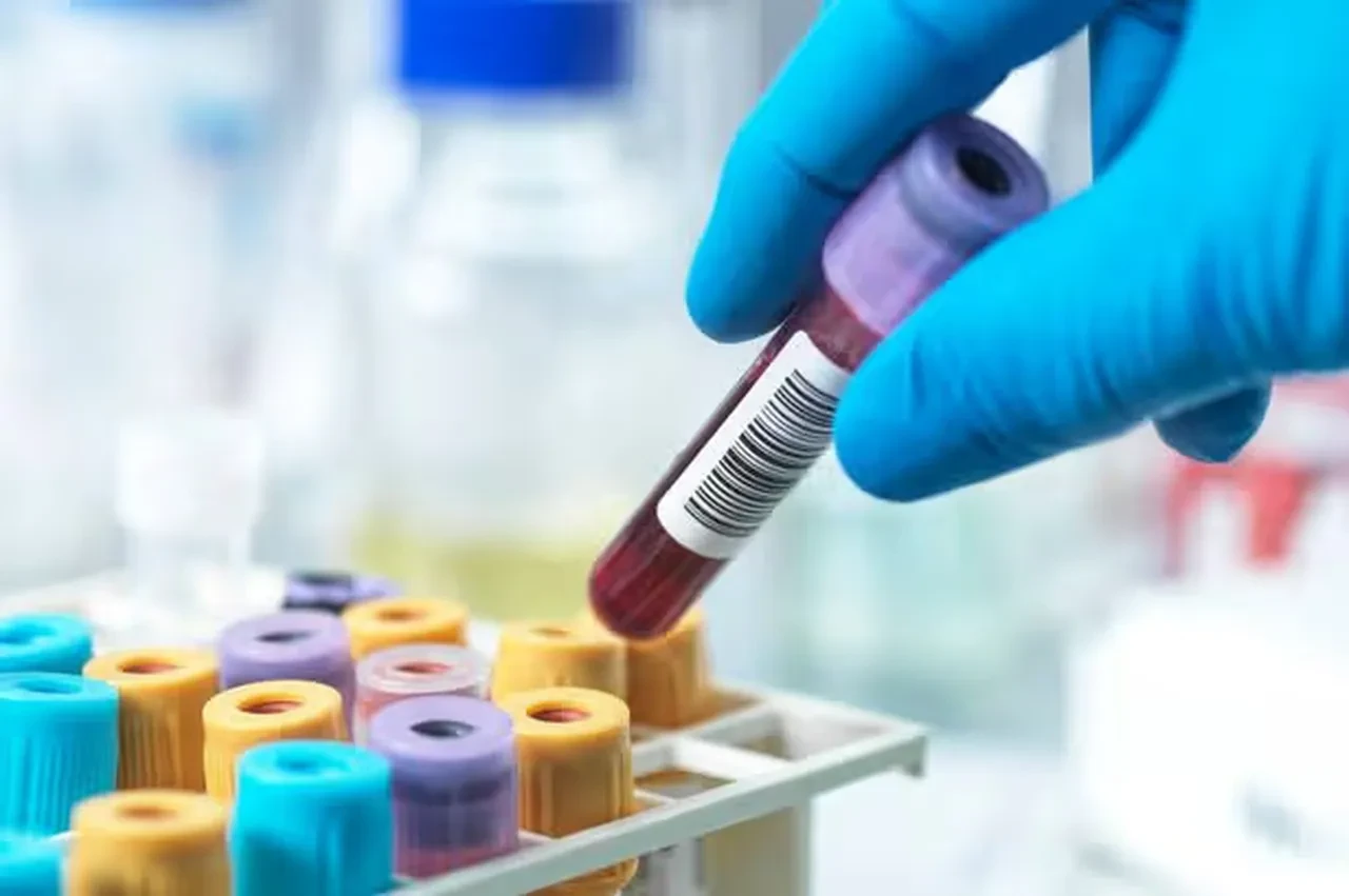 Tek damla kanla erken evre kanser teşhisi: Artık laboratuvar testlerine gerek kalmayacak