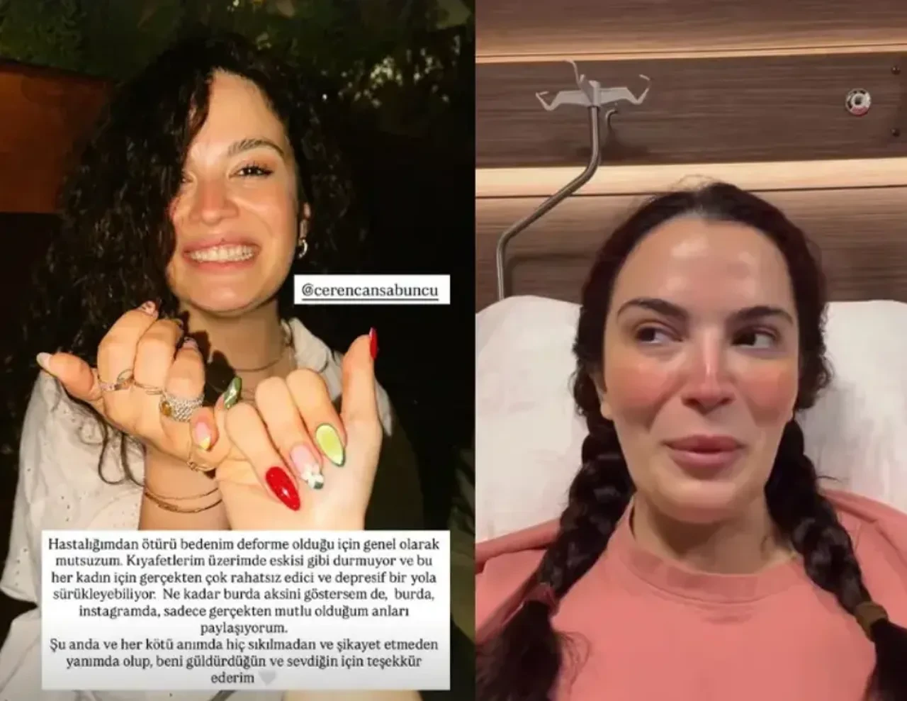 Bağırsağı kesilen Aslı Bekiroğlu'dan yeni paylaşım! 7'nci kez ameliyat olmuştu, son sağlık durumu üzdü