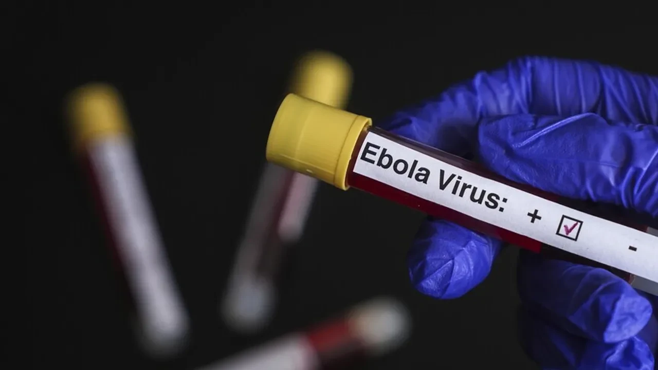 Belçika Ebola salgını için acil durum önlemlerini devreye aldı