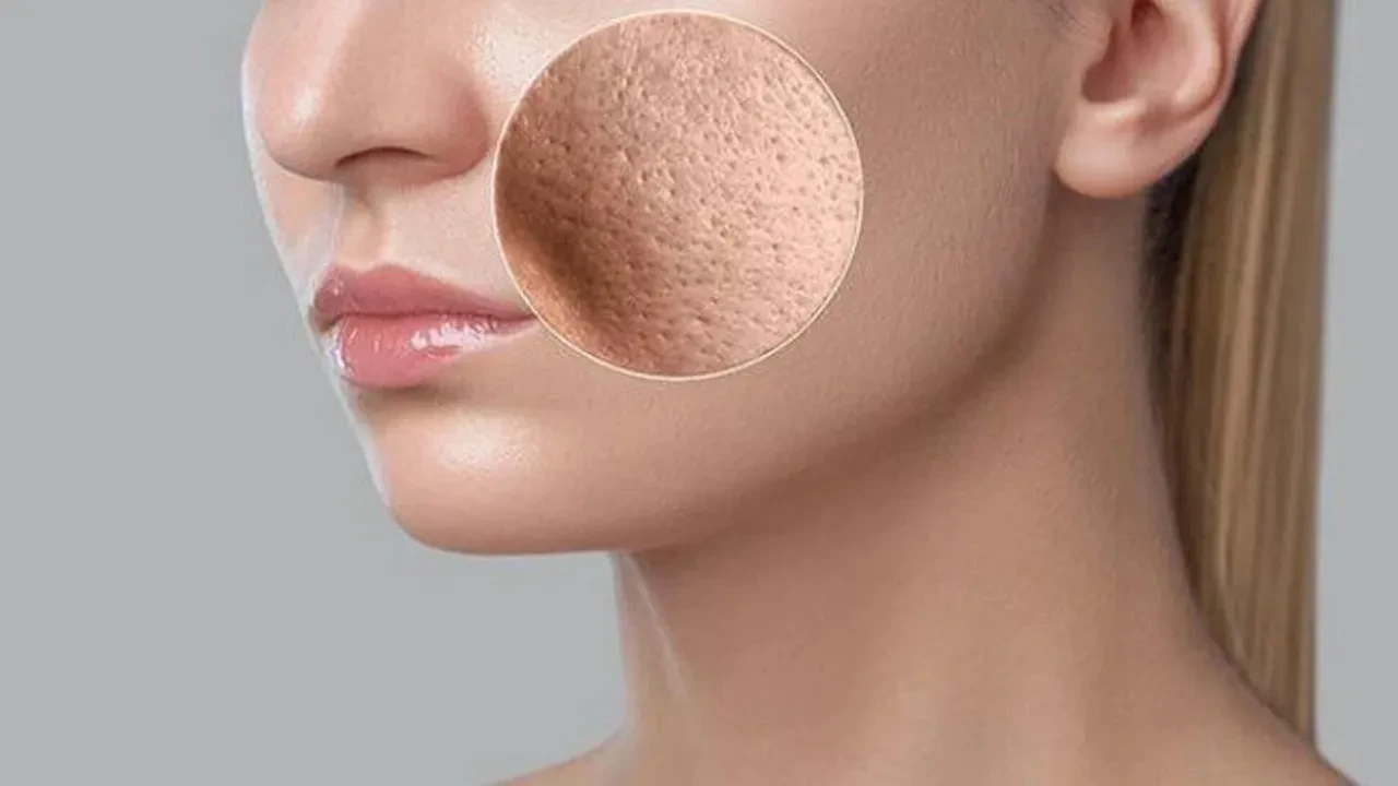 Cildi sıkılaştıran ve canlı gösteren doğal maske tarifi! Evde gençlik etkisi