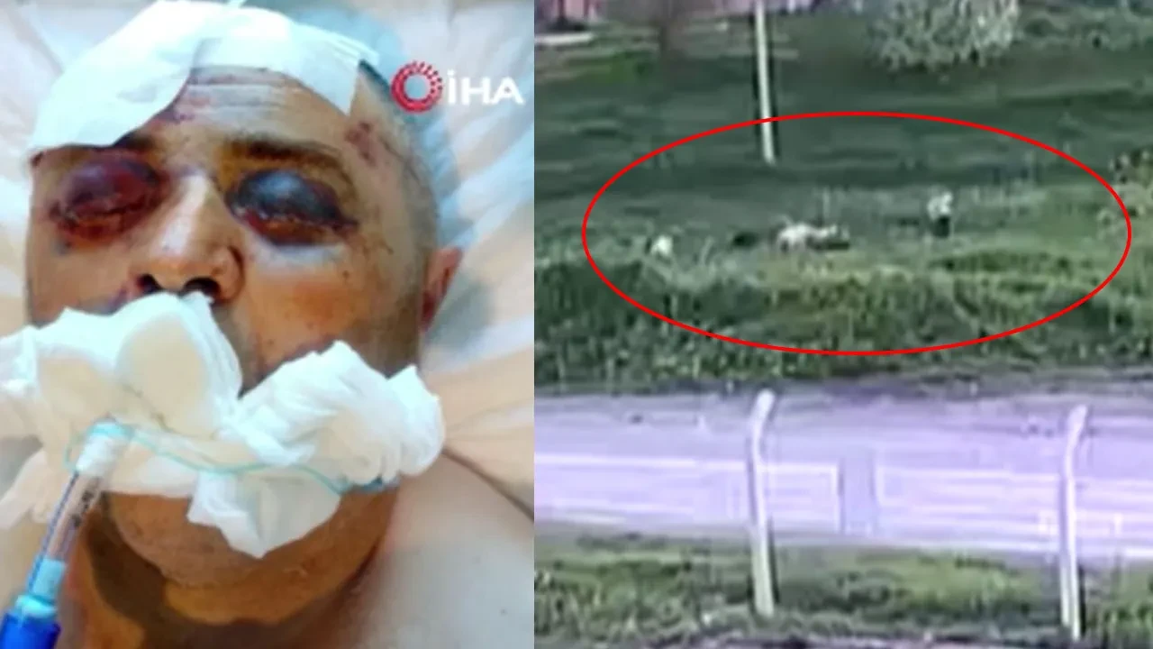 Ankara’daki 'köpek kavgası' dehşetinin görüntüleri ortaya çıktı! Komşusunu demir çubukla öldüresiye dövdü