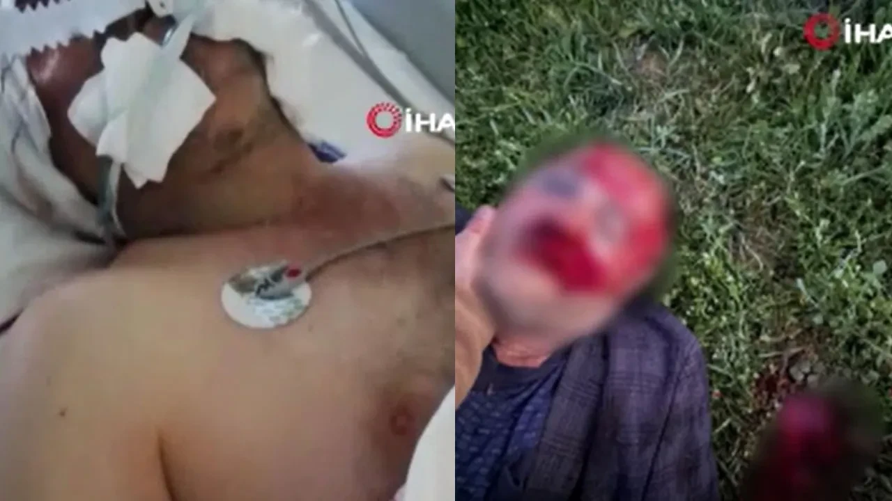 Ankara’daki 'köpek kavgası' dehşetinin görüntüleri ortaya çıktı! Komşusunu demir çubukla öldüresiye dövdü